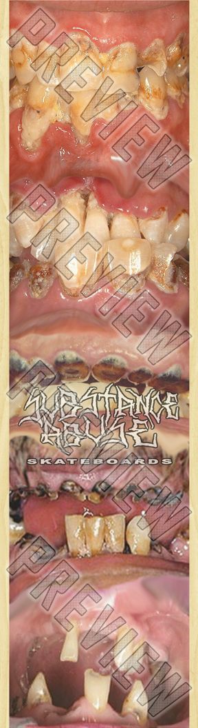 7-3/4 'METH MOUTH' Deck  7-3/4 Skateboard Deck 